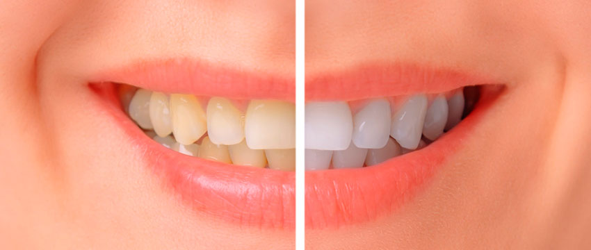 Estetica Dental