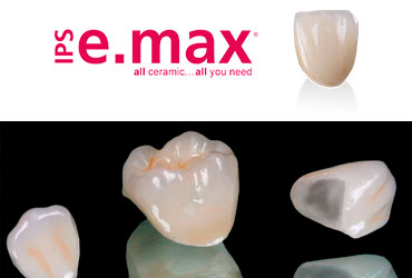 Estetica Dental