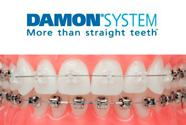 Estetica Dental