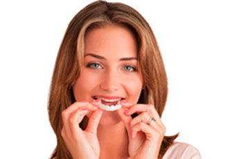 Implantes Dentales